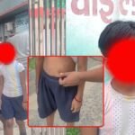 जमुई में 10 साल की बच्ची का बाल संरक्षण मामला