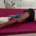 मुंगेर सदर अस्पताल में टूटे पैर पर प्लास्टर की जगह कार्टन बांधने का मामला