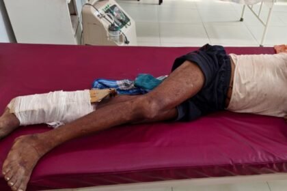 मुंगेर सदर अस्पताल में टूटे पैर पर प्लास्टर की जगह कार्टन बांधने का मामला