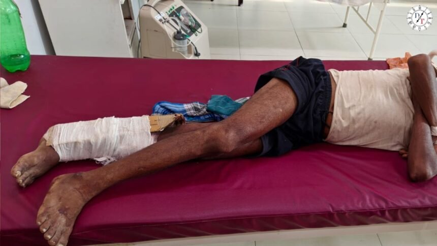 मुंगेर सदर अस्पताल में टूटे पैर पर प्लास्टर की जगह कार्टन बांधने का मामला